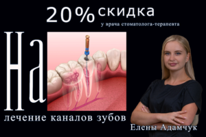 https://ls-stom.ru/20-skidka-na-lechenie-kanalo-zubov