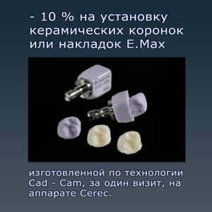 https://ls-stom.ru/informatsiya-dlya-patsientov/keramicheskie-koronki-ili-nakladki-e-max